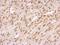 BRCA2 And CDKN1A Interacting Protein antibody, NBP1-31319, Novus Biologicals, Immunohistochemistry paraffin image 