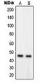 G Protein-Coupled Receptor Class C Group 5 Member B antibody, LS-C353470, Lifespan Biosciences, Western Blot image 
