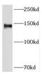 Large adhesive scatter factor 140 kDa subunit antibody, FNab04679, FineTest, Western Blot image 