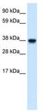 N-Myc And STAT Interactor antibody, TA339097, Origene, Western Blot image 