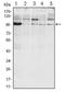 Serine/threonine-protein kinase/endoribonuclease IRE1 antibody, AM06424SU-N, Origene, Western Blot image 