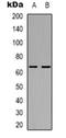 Serine/Threonine Kinase 39 antibody, orb319043, Biorbyt, Western Blot image 