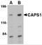 Calcium-dependent secretion activator 1 antibody, 4559, ProSci, Western Blot image 