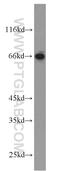 Hepatic leukemia factor antibody, 12870-1-AP, Proteintech Group, Western Blot image 