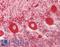 Calreticulin antibody, LS-B11268, Lifespan Biosciences, Immunohistochemistry paraffin image 