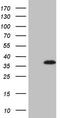 TP53 Regulating Kinase antibody, CF808226, Origene, Western Blot image 