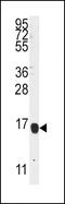 Arachidonate 5-Lipoxygenase Activating Protein antibody, 63-277, ProSci, Western Blot image 