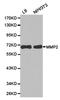 Matrix Metallopeptidase 2 antibody, TA327368, Origene, Western Blot image 