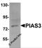 Protein Inhibitor Of Activated STAT 3 antibody, 5745, ProSci, Western Blot image 