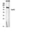 Sphingosine Kinase 2 antibody, STJ95748, St John