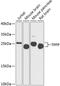 Tubulin Polymerization Promoting Protein antibody, GTX64740, GeneTex, Western Blot image 