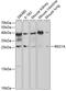 REG antibody, GTX66464, GeneTex, Western Blot image 
