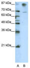Zinc Finger Protein 875 antibody, TA345616, Origene, Western Blot image 