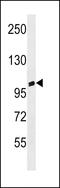 Ankyrin Repeat Domain 20 Family Member A3 antibody, 60-212, ProSci, Western Blot image 