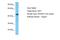 E2F Transcription Factor 3 antibody, NBP1-80295, Novus Biologicals, Western Blot image 