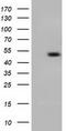 Carnosine N-Methyltransferase 1 antibody, TA501299S, Origene, Western Blot image 