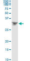 Homeobox protein DLX-4 antibody, LS-C197058, Lifespan Biosciences, Immunoprecipitation image 