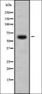 Coagulation Factor XI antibody, orb338196, Biorbyt, Western Blot image 