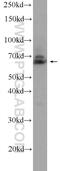 Ankyrin Repeat Domain 13A antibody, 23998-1-AP, Proteintech Group, Western Blot image 