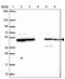 DnaJ Heat Shock Protein Family (Hsp40) Member A2 antibody, PA5-63874, Invitrogen Antibodies, Western Blot image 