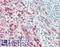 P2X purinoceptor 5 antibody, LS-B15498, Lifespan Biosciences, Immunohistochemistry paraffin image 