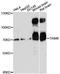 E3 ubiquitin-protein ligase TRIM9 antibody, A13896, ABclonal Technology, Western Blot image 