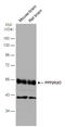 Protein Phosphatase 2 Regulatory Subunit Bdelta antibody, GTX116609, GeneTex, Western Blot image 