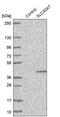 Solute Carrier Family 30 Member 7 antibody, PA5-53709, Invitrogen Antibodies, Western Blot image 
