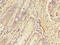 Endoplasmic Reticulum-Golgi Intermediate Compartment 1 antibody, CSB-PA842630LA01HU, Cusabio, Immunohistochemistry paraffin image 