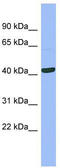 Serpin B13 antibody, TA346465, Origene, Western Blot image 