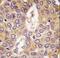 Casein Kinase 1 Gamma 2 antibody, LS-C100601, Lifespan Biosciences, Immunohistochemistry paraffin image 