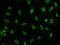SS18 Subunit Of BAF Chromatin Remodeling Complex antibody, 203264-T02, Sino Biological, Immunohistochemistry paraffin image 