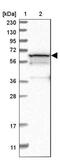 Phosphoglucomutase 1 antibody, NBP1-85977, Novus Biologicals, Western Blot image 