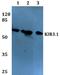 Potassium Voltage-Gated Channel Subfamily J Member 3 antibody, A05677, Boster Biological Technology, Western Blot image 
