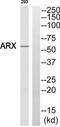 Homeobox protein ARX antibody, TA316203, Origene, Western Blot image 