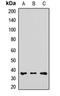 Retinol Dehydrogenase 5 antibody, orb412673, Biorbyt, Western Blot image 