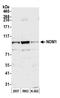 Nucleolar Protein With MIF4G Domain 1 antibody, A305-844A-M, Bethyl Labs, Western Blot image 