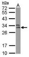 Major Histocompatibility Complex, Class II, DP Beta 1 antibody, PA5-27780, Invitrogen Antibodies, Western Blot image 