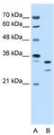 Acidic Nuclear Phosphoprotein 32 Family Member E antibody, TA339368, Origene, Western Blot image 