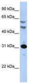 Homeobox protein Hox-B5 antibody, TA344486, Origene, Western Blot image 