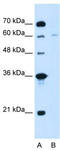 Chromatin Assembly Factor 1 Subunit B antibody, TA338926, Origene, Western Blot image 