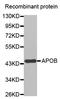 Apolipoprotein B antibody, STJ22647, St John