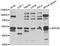 ADP Dependent Glucokinase antibody, STJ29252, St John