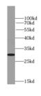 Protein Tyrosine Phosphatase Receptor Type C Associated Protein antibody, FNab06943, FineTest, Western Blot image 