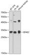 Eukaryotic Translation Initiation Factor 4E Family Member 2 antibody, GTX64395, GeneTex, Western Blot image 