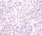 Tachykinin Receptor 1 antibody, A54105-100, Epigentek, Immunohistochemistry paraffin image 