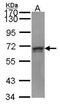 Pre-MRNA Processing Factor 31 antibody, GTX107696, GeneTex, Western Blot image 