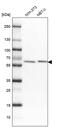 Putative adenosylhomocysteinase 2 antibody, PA5-60038, Invitrogen Antibodies, Western Blot image 