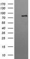Hepatocyte Growth Factor-Regulated Tyrosine Kinase Substrate antibody, CF505894, Origene, Western Blot image 