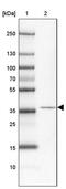 Coiled-Coil Domain Containing 113 antibody, PA5-59286, Invitrogen Antibodies, Western Blot image 